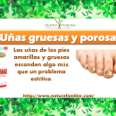 Tratamiento para las uñas gruesas y porosas